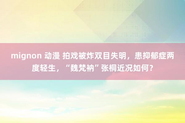 mignon 动漫 拍戏被炸双目失明，患抑郁症两度轻生，“魏梵衲”张桐近况如何？